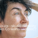 Menopauza – skutki dla skóry i nie tylko. Co warto wiedzieć?