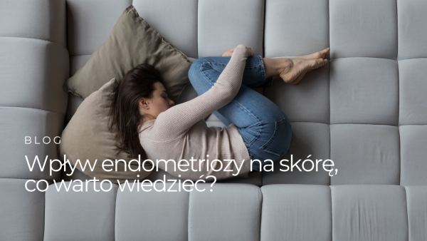 Wpływ endometriozy na skórę – co warto wiedzieć?