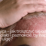 Łuszczyca – jak troszczyć się o skórę głowy, ciało i paznokcie, by naprawdę poczuć ulgę?
