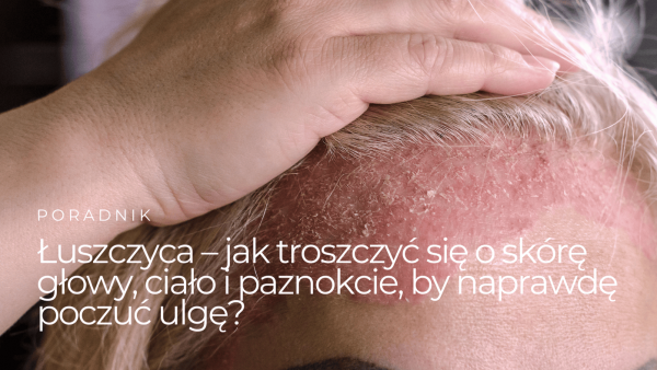 Łuszczyca – jak troszczyć się o skórę głowy, ciało i paznokcie, by naprawdę poczuć ulgę?
