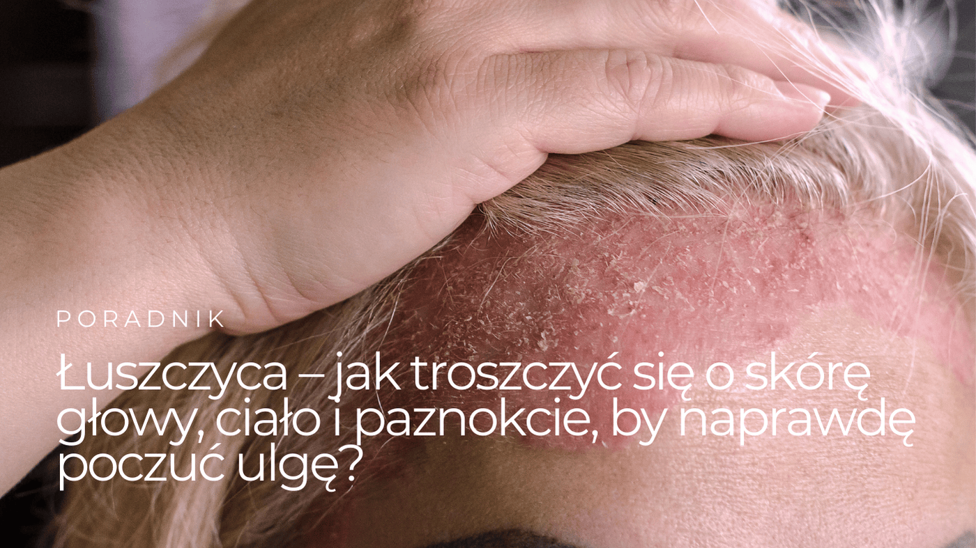 luszczyca-skory-glowy-i-ciala