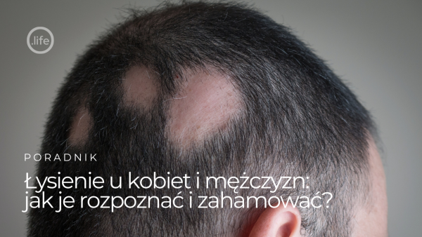 Łysienie u kobiet i mężczyzn – jak je rozpoznać i zahamować?