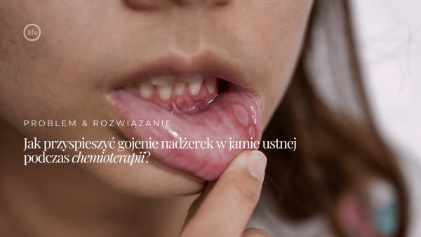 Jak przyspieszyć gojenie nadżerek w&nbsp;jamie ustnej podczas chemioterapii?
