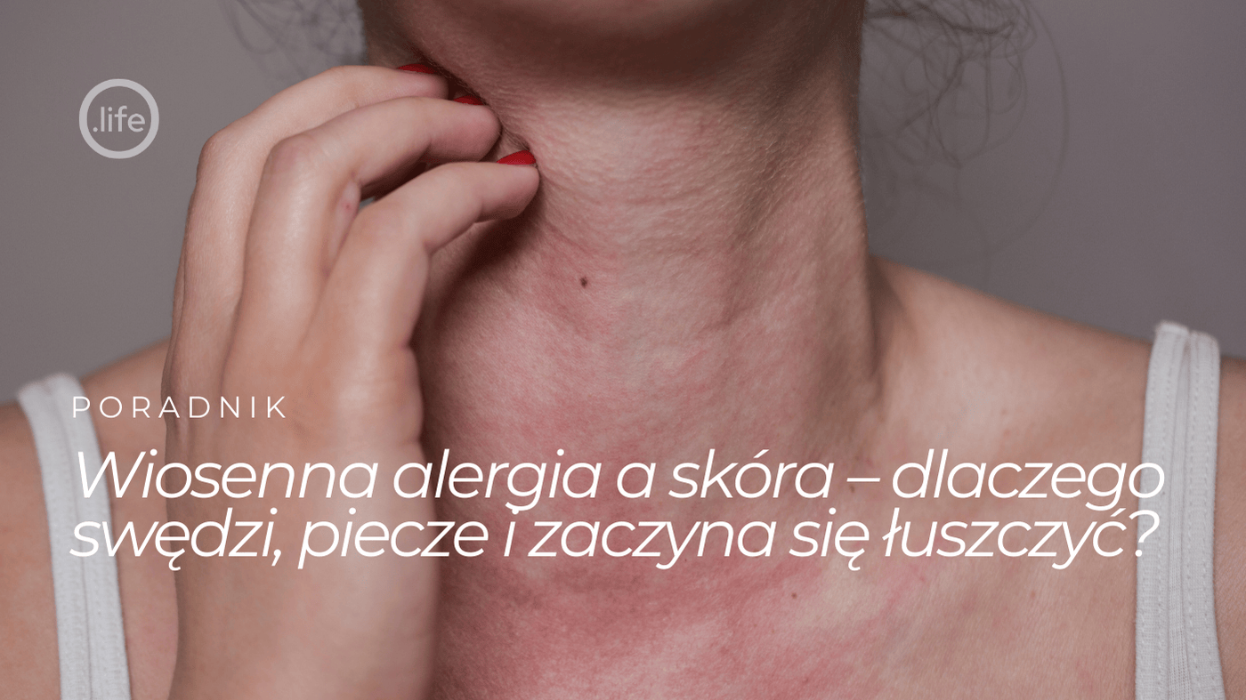 Wiosenne alergie a skóra: dlaczego zaczyna swędzieć, piec i łuszczyć się właśnie teraz?