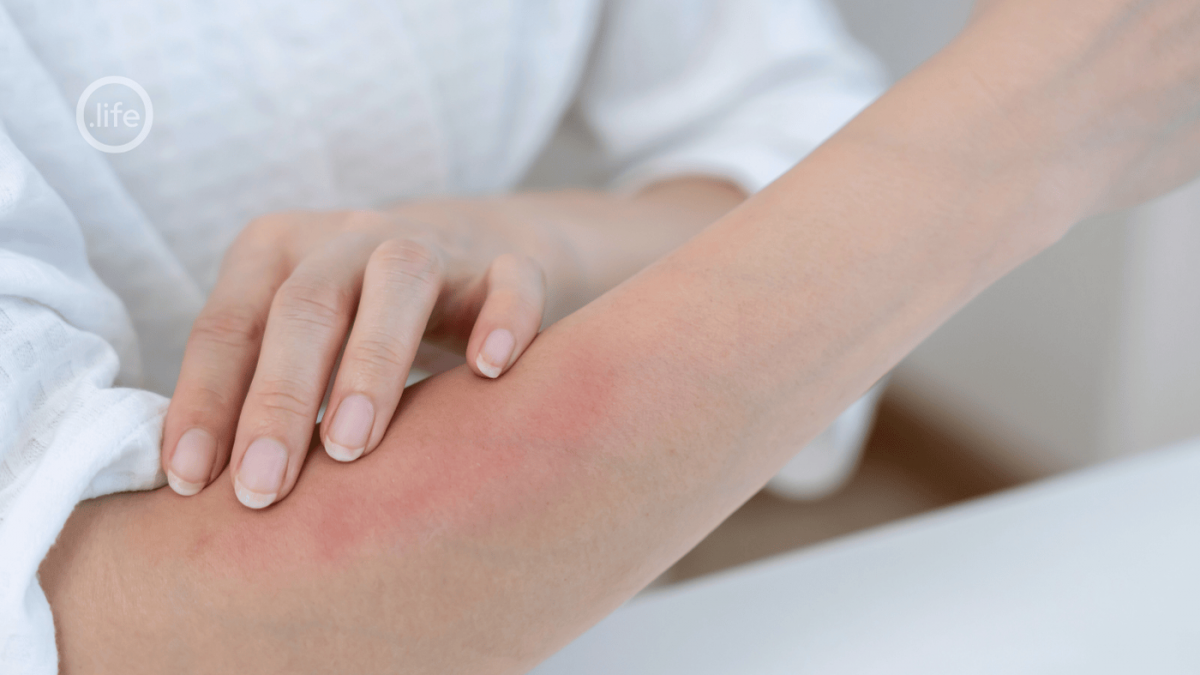 alergia wiosenna swędzenie i odczyny na skórze