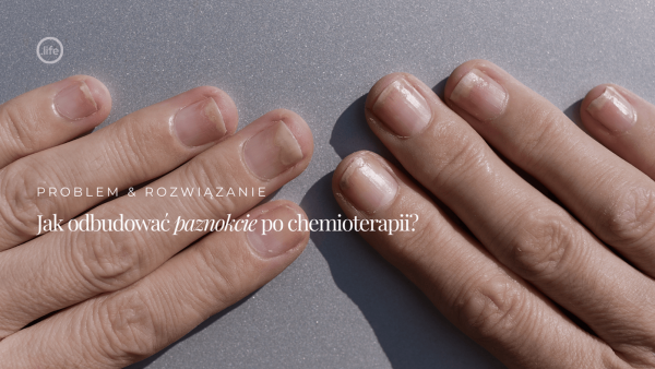 Jak odbudować paznokcie po&nbsp;chemioterapii?