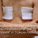 Kiedy najlepiej zacząć pielęgnację blizny po&nbsp;mastektomii i&nbsp;jak ją&nbsp;pielęgnować w&nbsp;trakcie radioterapii?