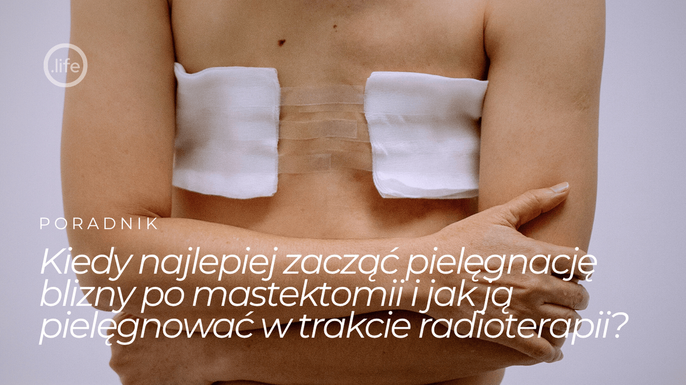 Kiedy najlepiej zacząć pielęgnację blizny po mastektomii i jak ją pielęgnować w trakcie radioterapii?