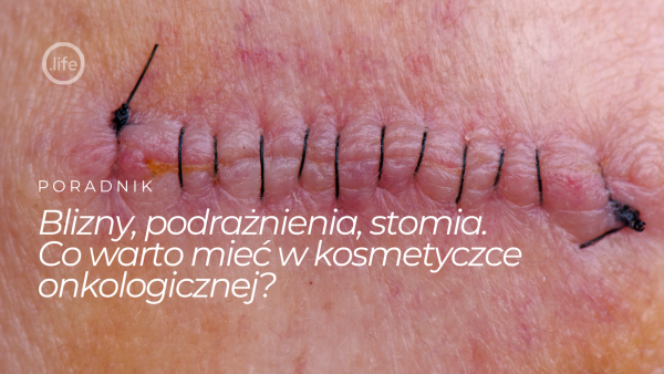 Blizny, podrażnienia, stomia. Co&nbsp;warto mieć w&nbsp;kosmetyczce onkologicznej?
