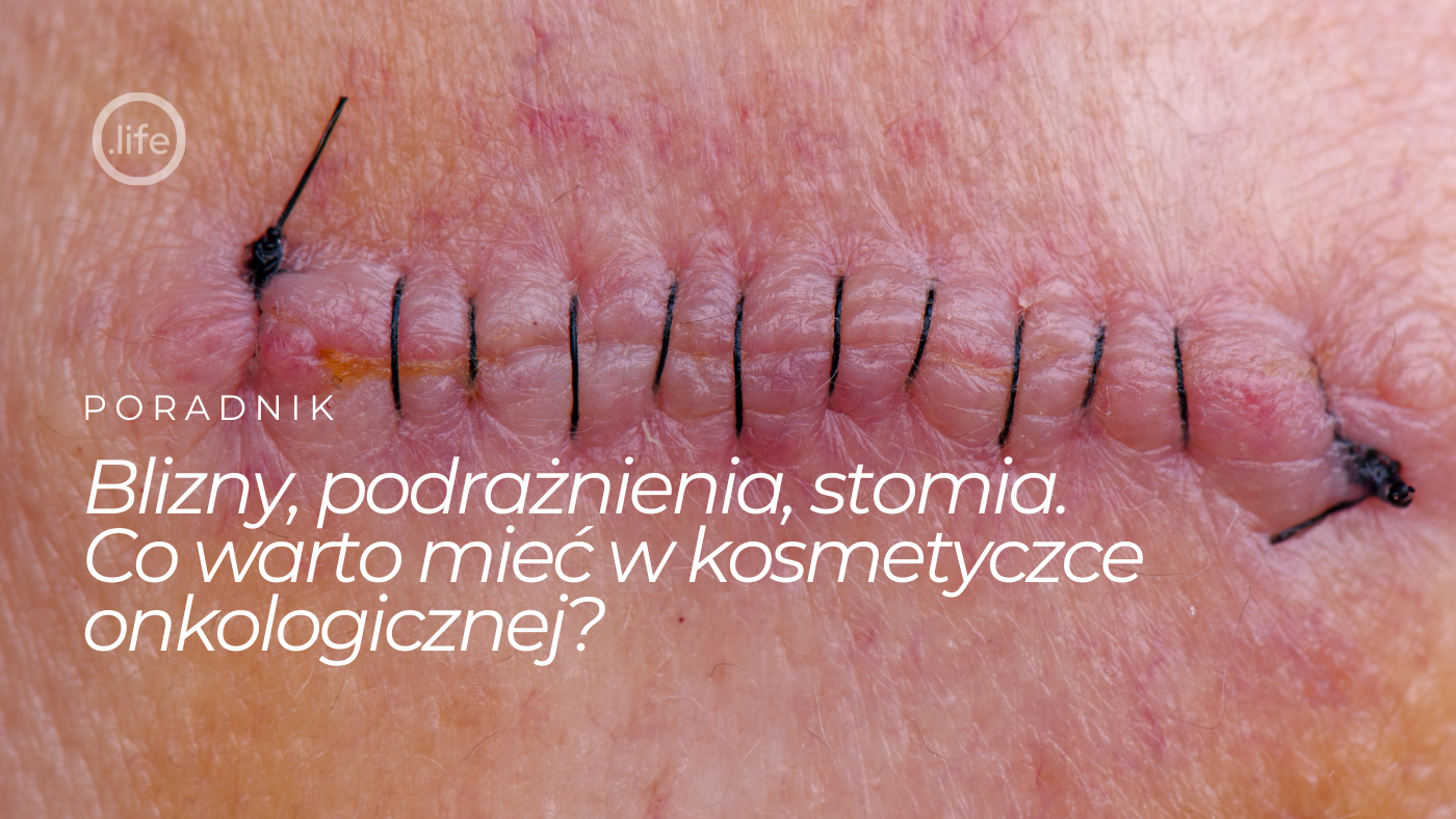 Co warto mieć w kosmetyczce onkologicznej?