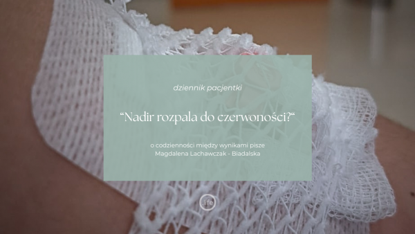Nadir rozpala do&nbsp;czerwoności?