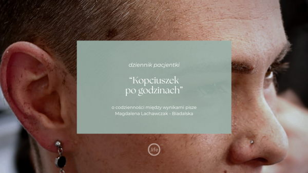 Kopciuszek po&nbsp;godzinach
