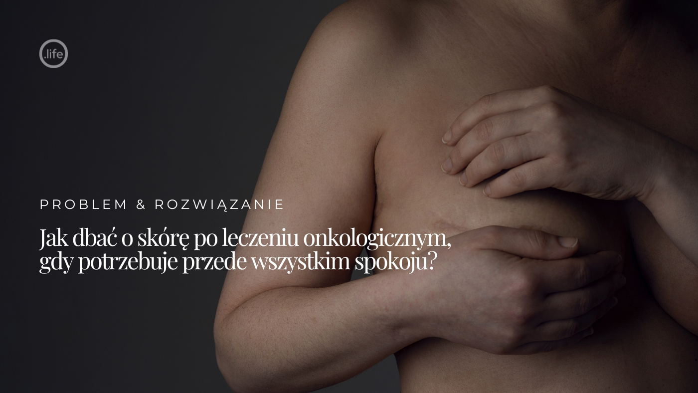 Jak dbać o skórę po leczeniu onkologicznym, gdy potrzebuje przede wszystkim spokoju?
